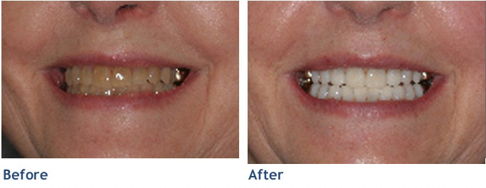 This woman now has a much younger smile